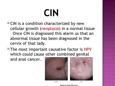 cin medical term