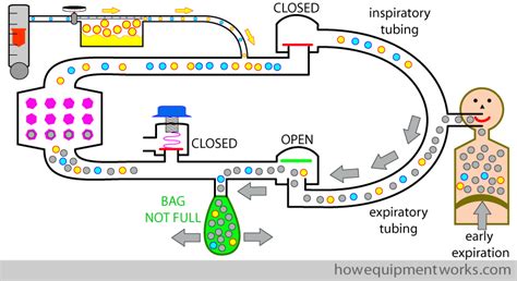Circle Circuit Anesthesia