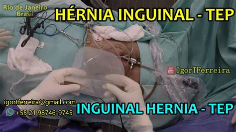 cirurgia de hérnia inguinal nome