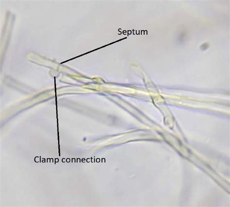 Clamp Connections Fungi