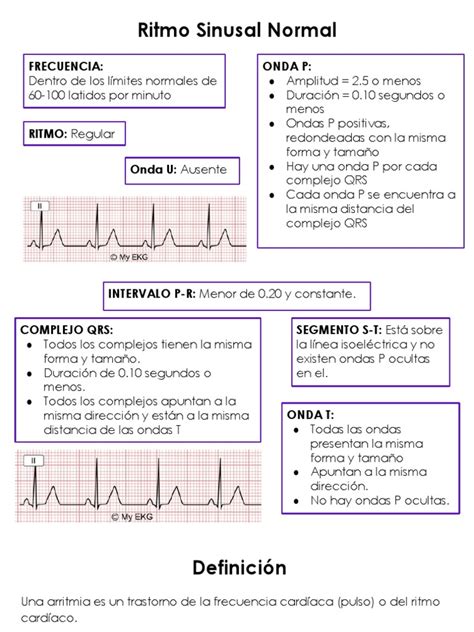 clasificacion de las arritmias pdf