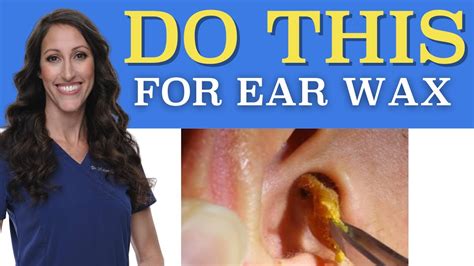 Effective Ways to Clean Ear Wax Safely at Home