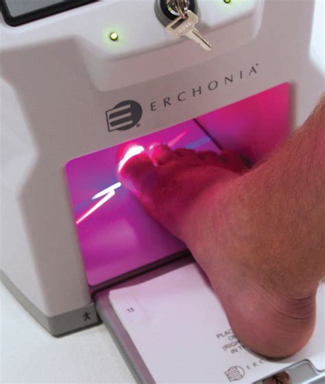 clear nail laser clinics review
