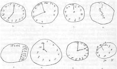 clock drawing cognitive test