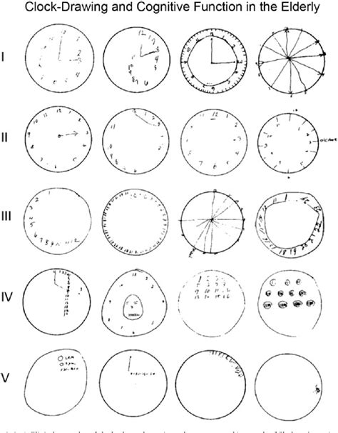 clock drawing interpretation