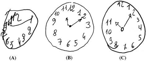 clock drawing scoring
