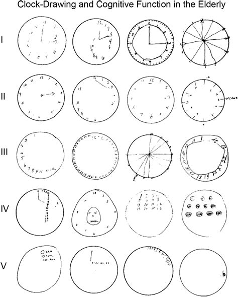 clock drawing test dementia