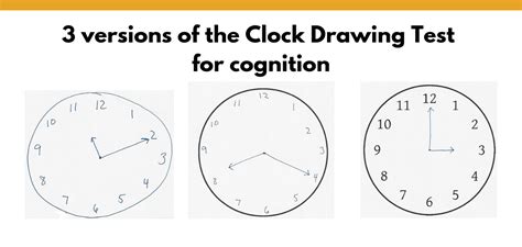 Clock Drawing Test Examples