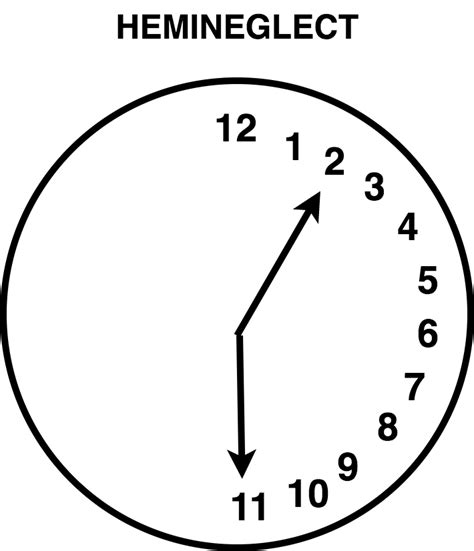 Clock Drawing Test Hemineglect