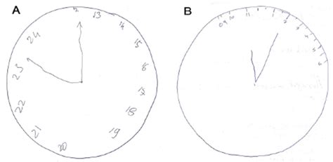 Clock Drawing Test Mirror Image