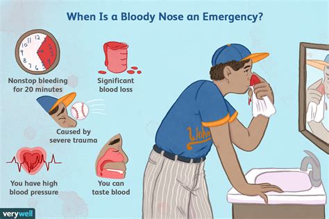 What You Need to Know About Clots in a Nosebleed: Causes and Concerns