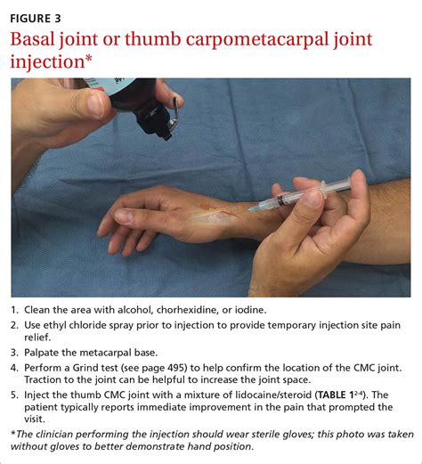 cmc joint injection cpt