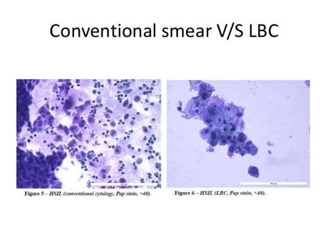 coccobacilli consistent with shift in flora
