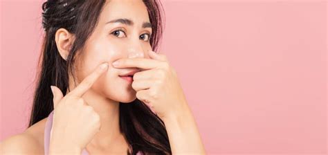 coffee can cause pimples