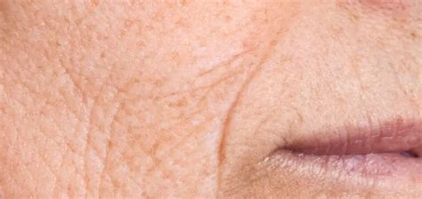 Coffee Grounds Remove Wrinkles