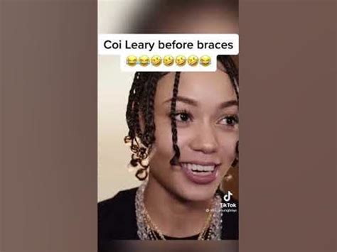 Coi Leray Gets Her Braces Off! Were Coi Leray's Gold Braces Real