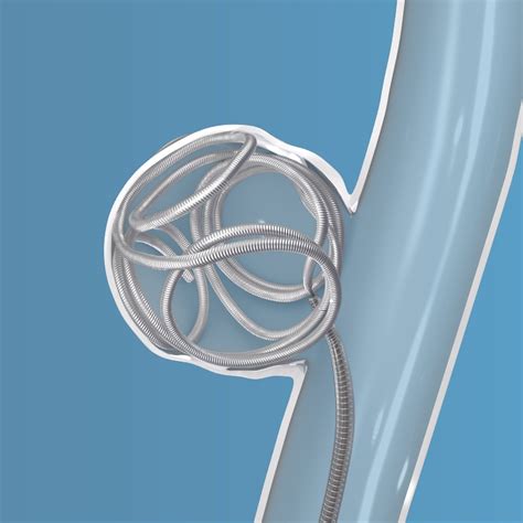 Coil Embolization Neurovascular