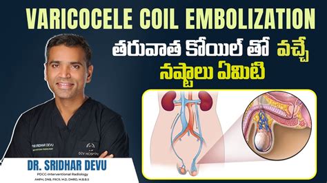 Coil Embolization Side Effects