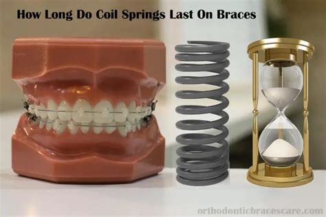 Coil Spring Braces Purpose