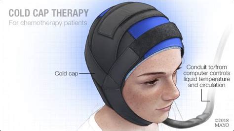 Protecting Your Locks During Chemo: The Benefits of a Cold Cap for Chemo Patients