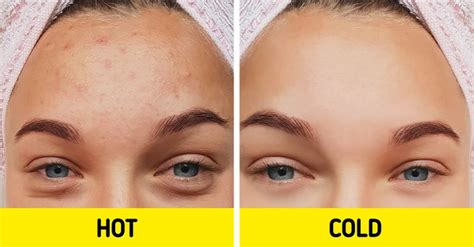 Cold Shower For Puffy Face