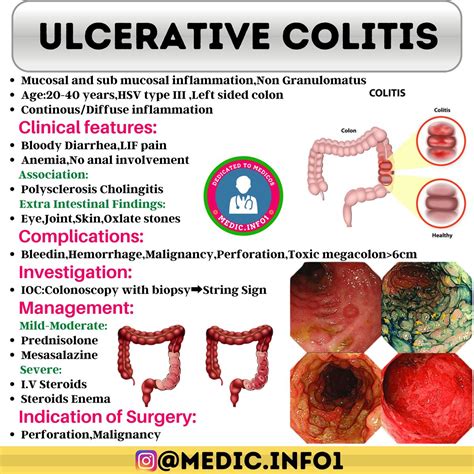 Cold Shower Ulcerative Colitis