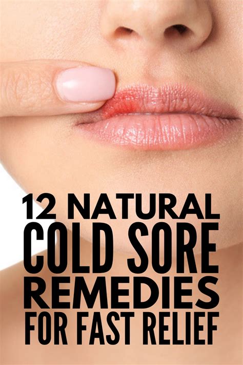 Heal Faster: Effective Cold Sores Selfcare Tips Revealed