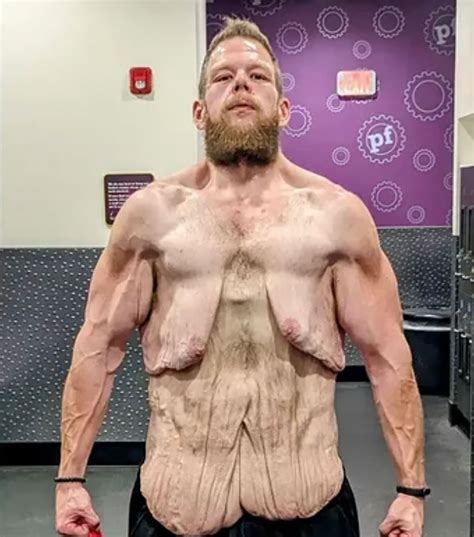 cole prochaska gofundme