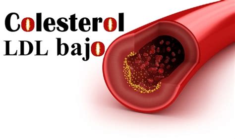 colesterol ldl bajo