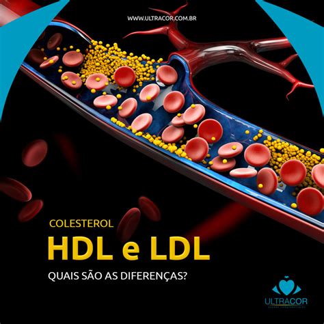 colesterol ldl e hdl