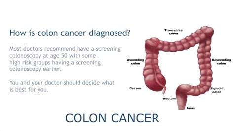 colon cancer meaning in tamil