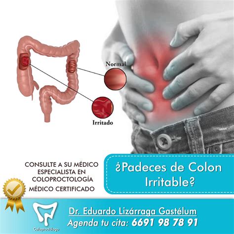 Colon Irritable Sintomas: Conozca los Signos de Alerta