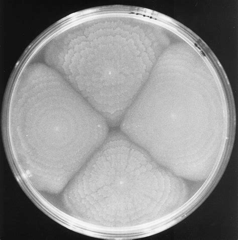 colonies of vibrio parahaemolyticus in bap