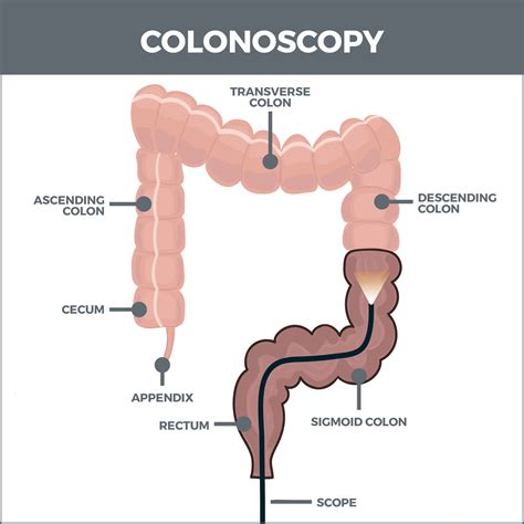 colonoscopy to anastomosis cpt