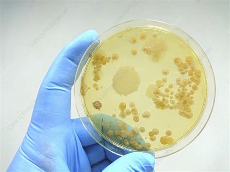 colony definition microbiology