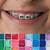 color for braces