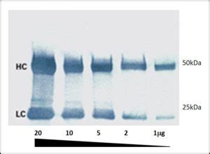 Colorimetric Detection Western Blot
