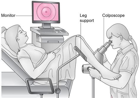 Understanding Colposcopy & Biopsy: Cervical Health Insights