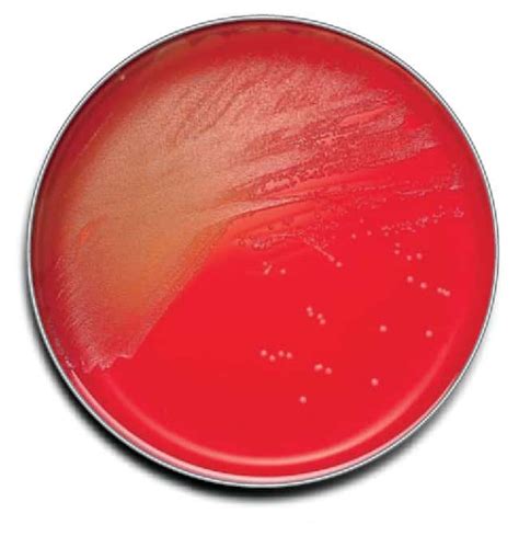 columbia cna blood agar