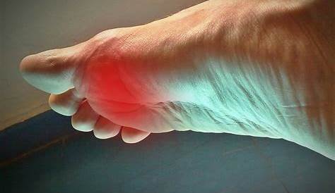 Ne souffrez pas avec un pied d’athlète quand vous pouvez utiliser l’un