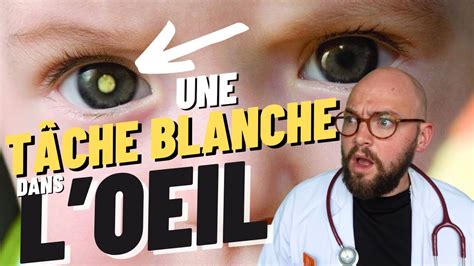 Faire disparaître un vaisseau éclaté dans l’œil voici comment faire! Dynoptic
