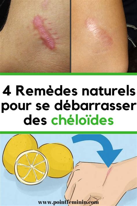 Comment faire partir une cheloide Terrence Schneider