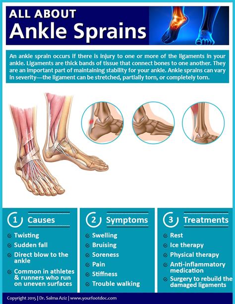 common causes of ankle sprains
