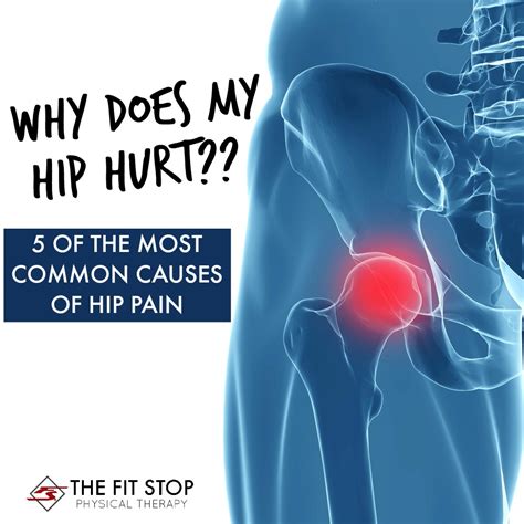 common causes of hip pain