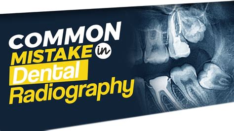 Common Dental Radiographic Errors