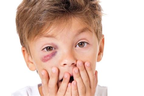 Common Eye Injuries in Children