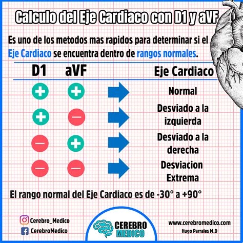 Eje Cardíaco Como calcular el Eje Cardíaco en el EKG paso a paso.