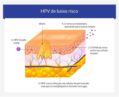 como funciona o hpv