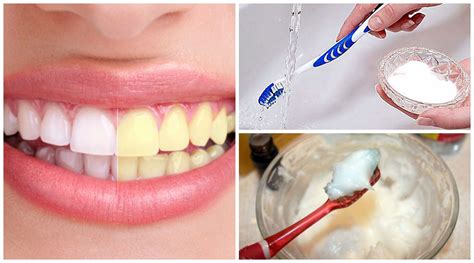 como limpiar los dientes con bicarbonato