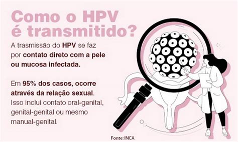 como se contrai hpv